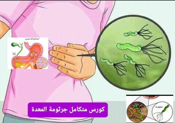 8️⃣🪢كورس جرثومة المعدة