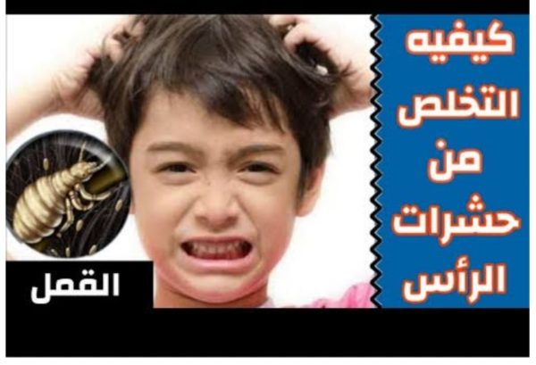 6️⃣💆‍♂️القضاء على حشرات الراس